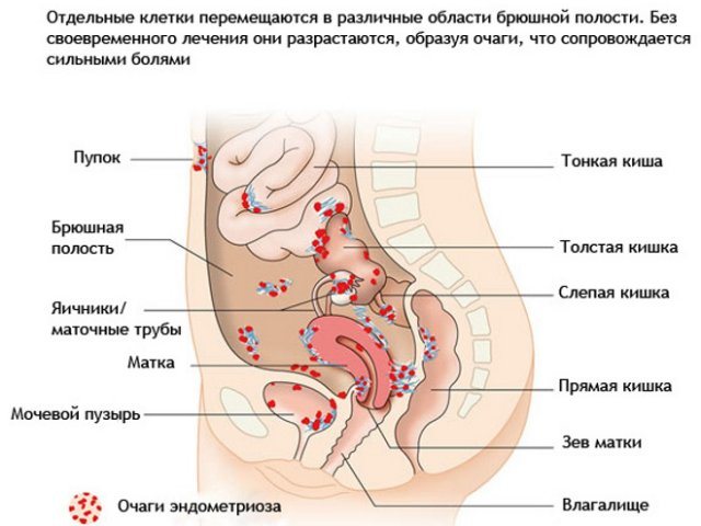 Издърпва долната част на корема и боли в гърдите - причини, възможни заболявания